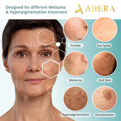 Abera Melasma Serum Genowhite ingredient highlight, supports pigment balance over time.