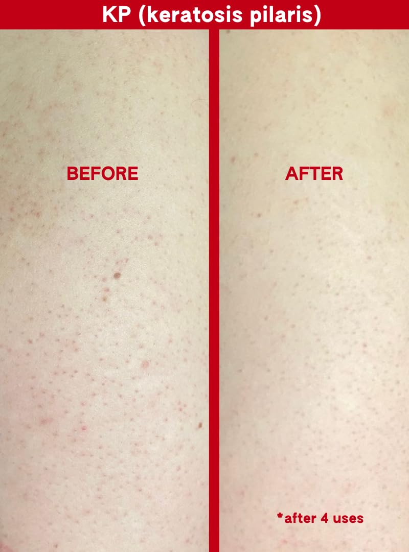 Abi Ame KP texture closeup hints at smoother areas after use.