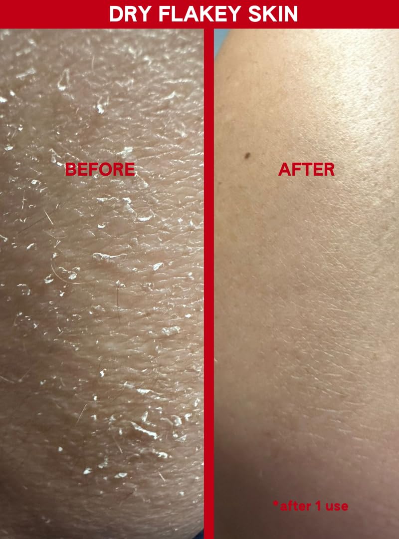 Abi Ame Silky-Soft-Skin closeup after use with refined texture.
