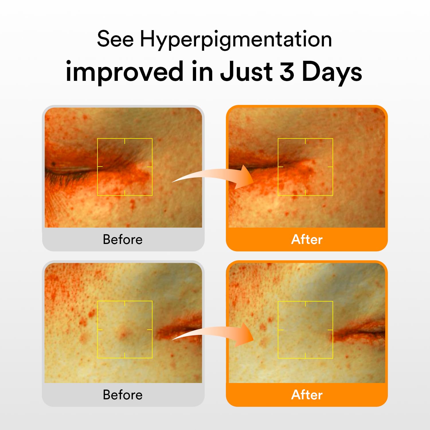 Abib Glutathiosome dark spot serum pump-dispense showing easy, mess-free application.
