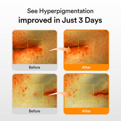 Abib Glutathiosome dark spot serum pump-dispense showing easy, mess-free application.