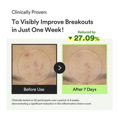 Abib Heartleaf Centella application demonstrates gentle care for troubled skin.