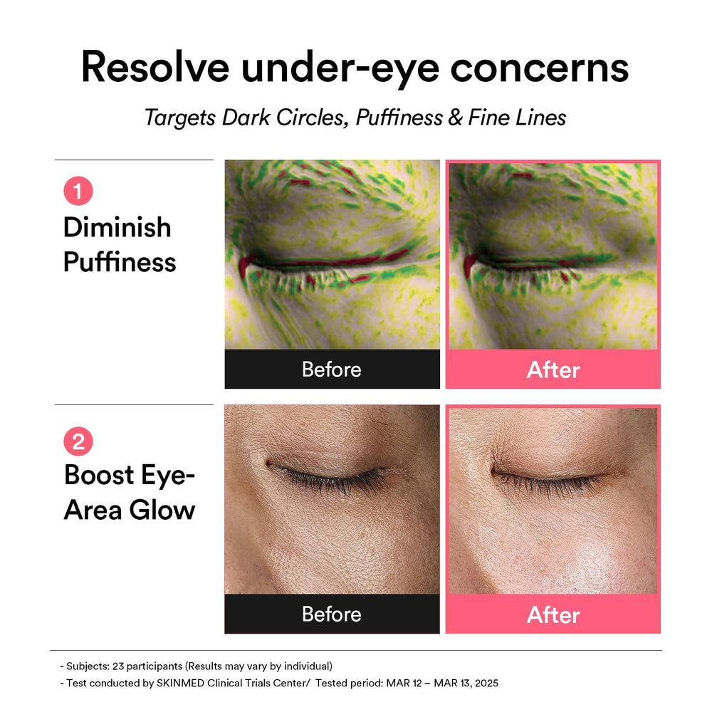 Abib PDRN Retinal Eye Patch close-up shows cooling hydration for puffiness relief.