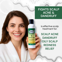 Acne Zap bottle with Made in USA badge signaling quality.