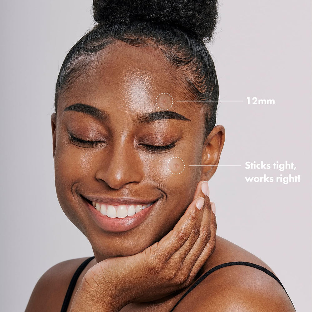 Acropass Microcone patch applied to early acne helps cover and protect the area.