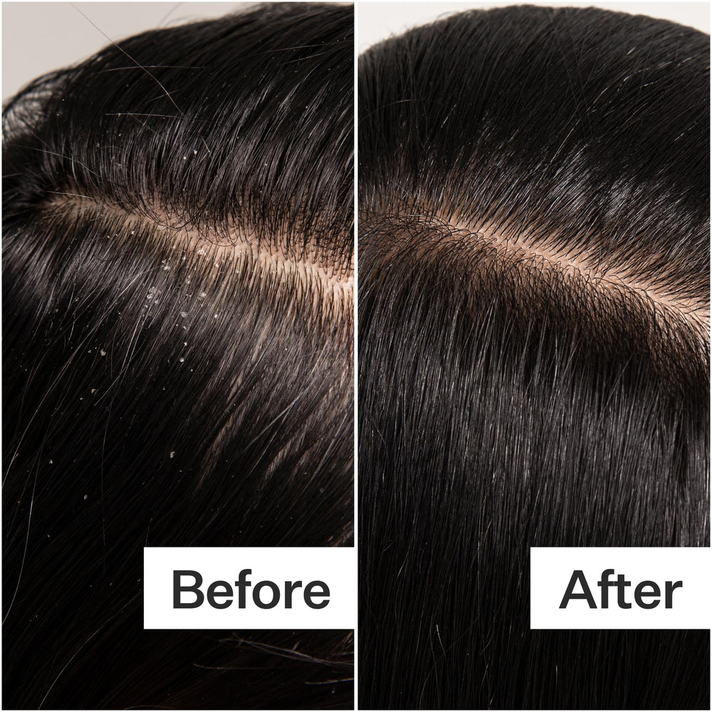 ACT+ ACRE after-use image suggests silky scalp and smoother hair.