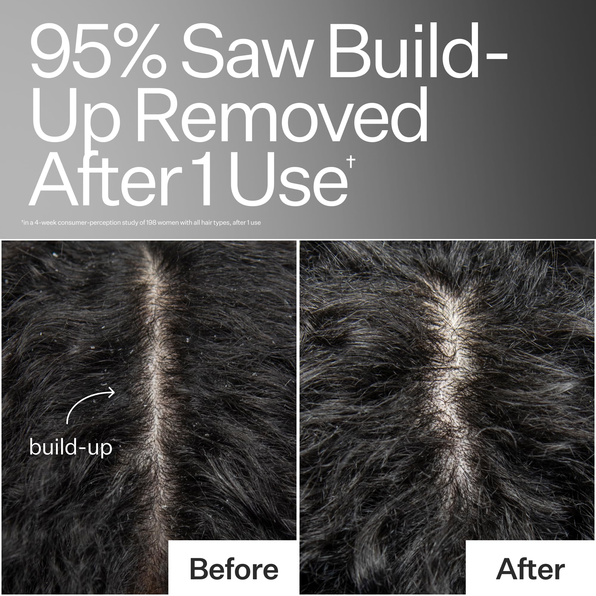 ACT+ ACRE basil leaf hydration ingredient closeup emphasizes deep moisture for scalp.