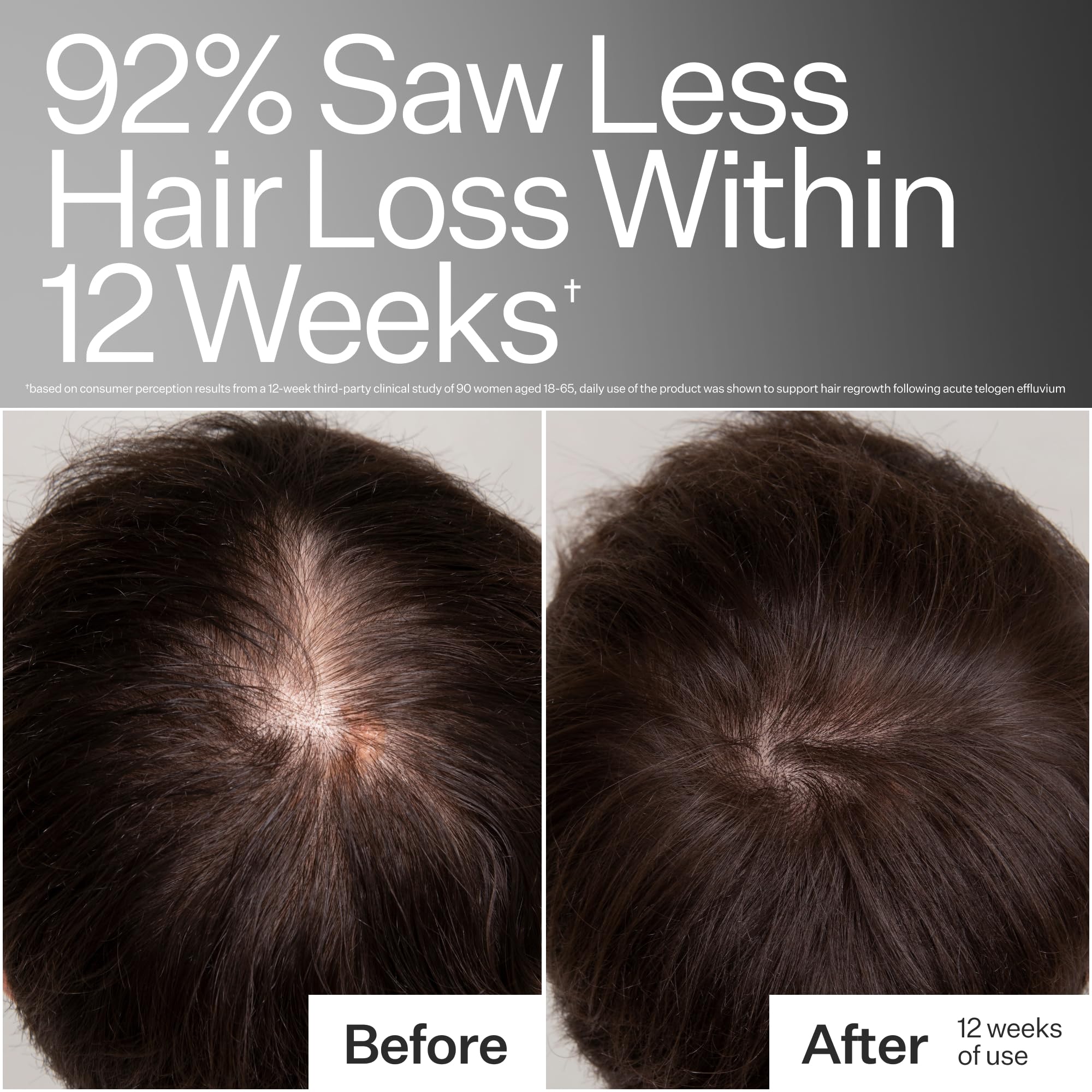 ACT+ ACRE caffeine infusion visible on product image for scalp energizing effect