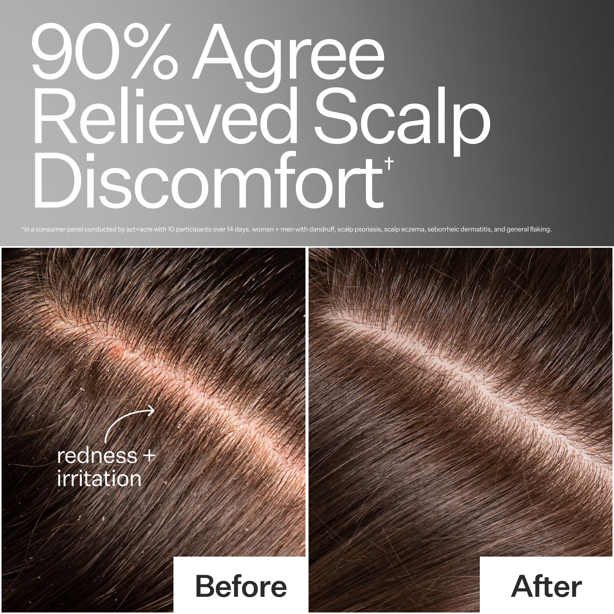 ACT+ ACRE Microbiome Cooling Scalp Serum on fingertips ready for massage
