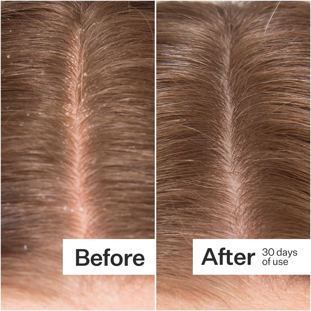 ACT+ ACRE Microbiome Cooling Scalp Serum pipettes demonstrate targeted application