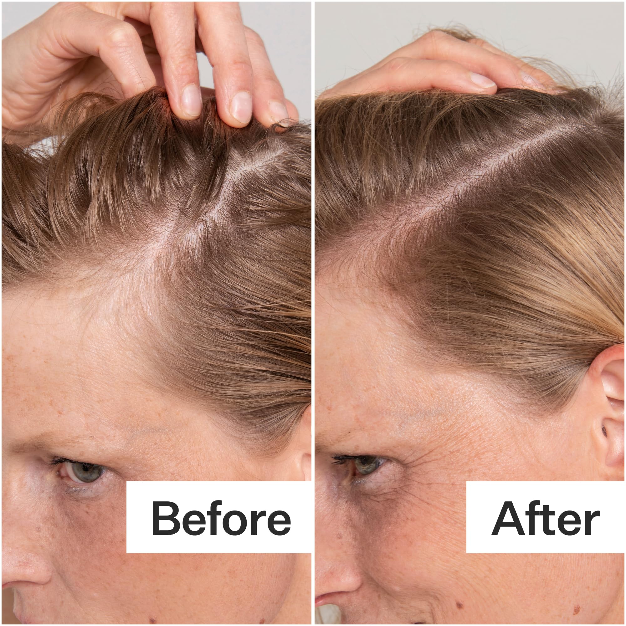act-acre peppermint oil drops focus for cooling scalp relief