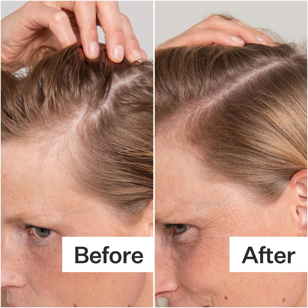 act-acre peppermint oil drops focus for cooling scalp relief