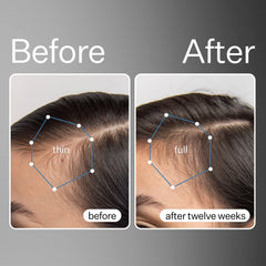 ACT+ ACRE stem cell serum application dropper mid scalp application for hydration.