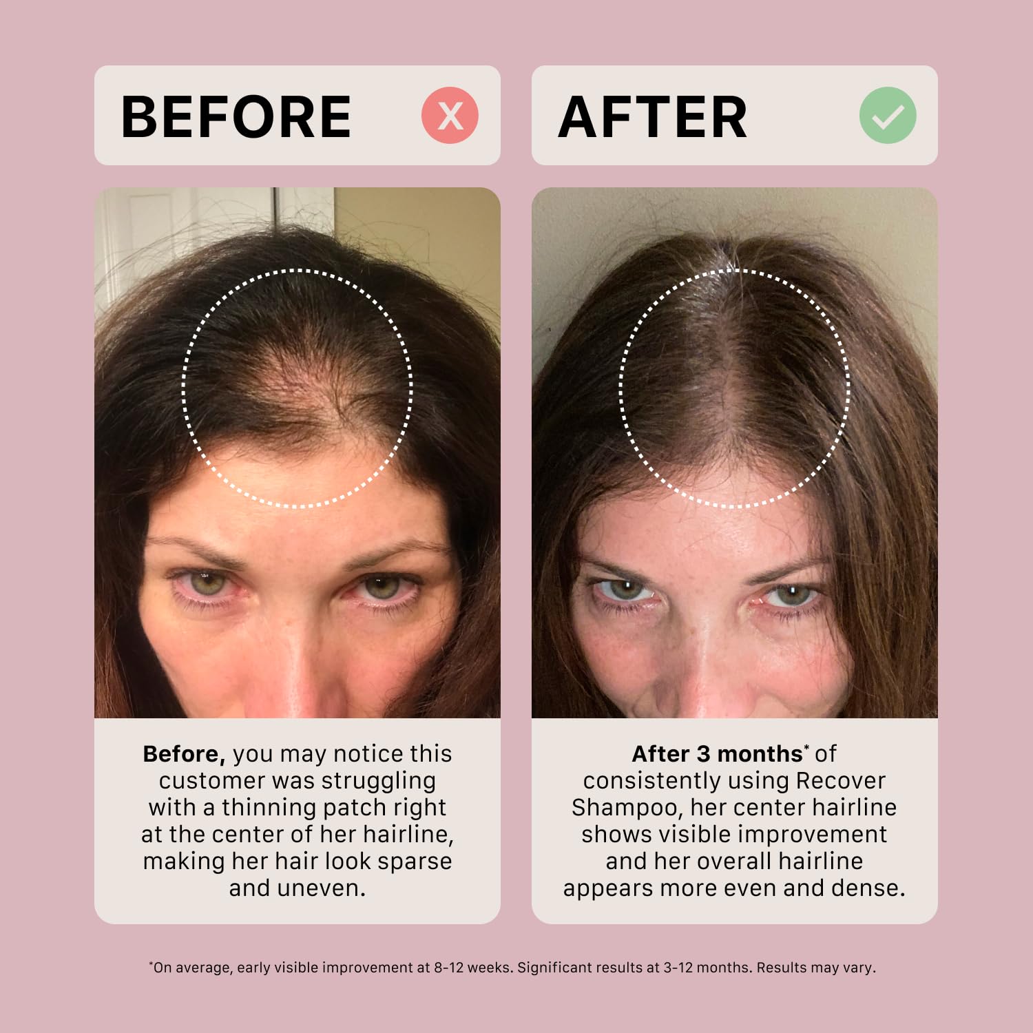 ACTIIV Recover all-hair-types imagery implies versatile cleansing for every hair type.