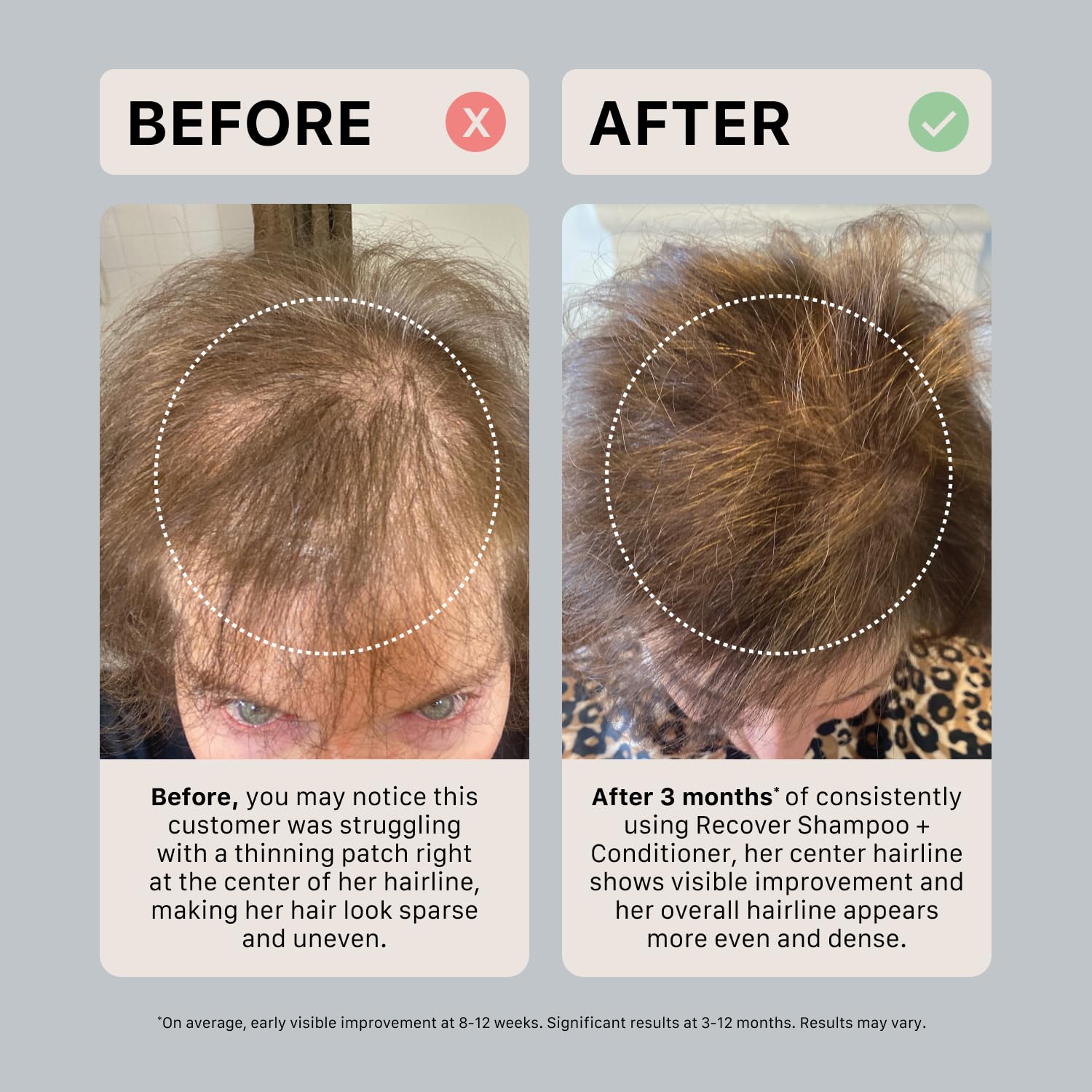 ACTIIV Recover packaging notes color-safe solution, supporting color retention between washes.