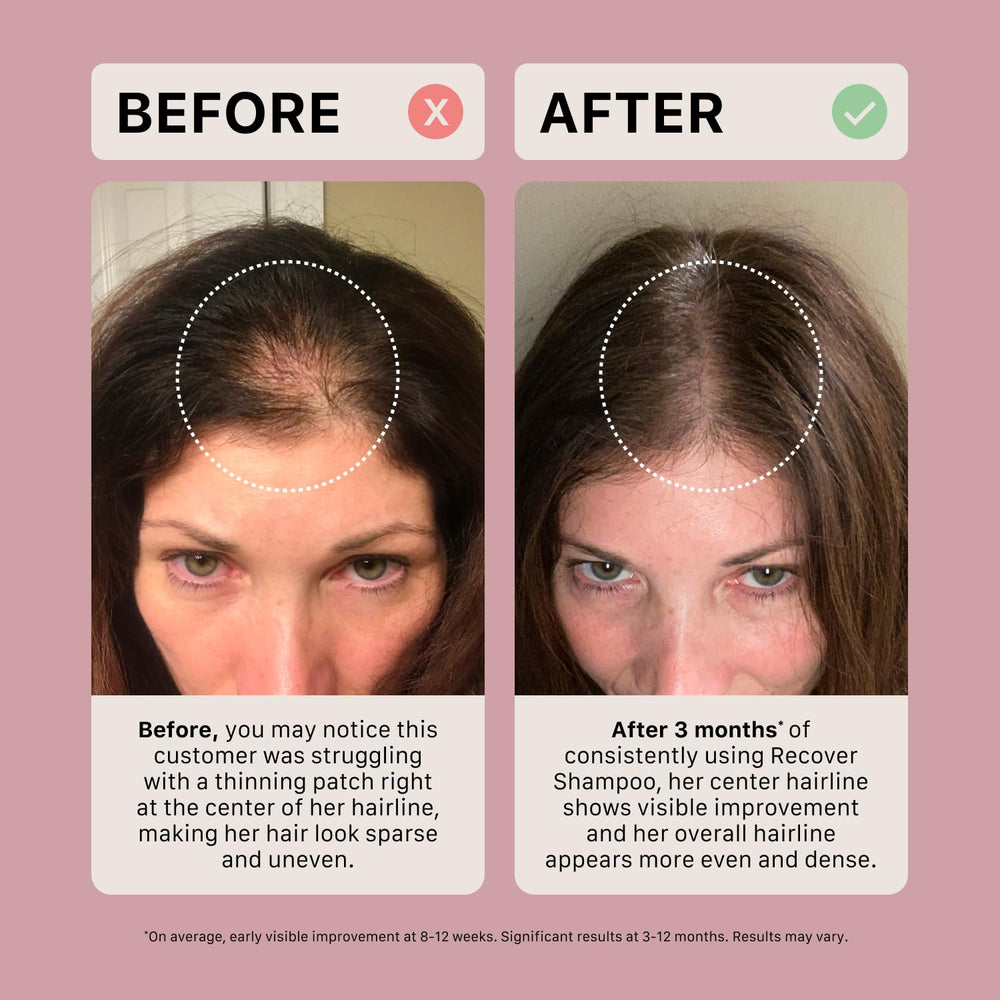 ACTIIV Recover shampoo color-safe formula on hair strand close-up