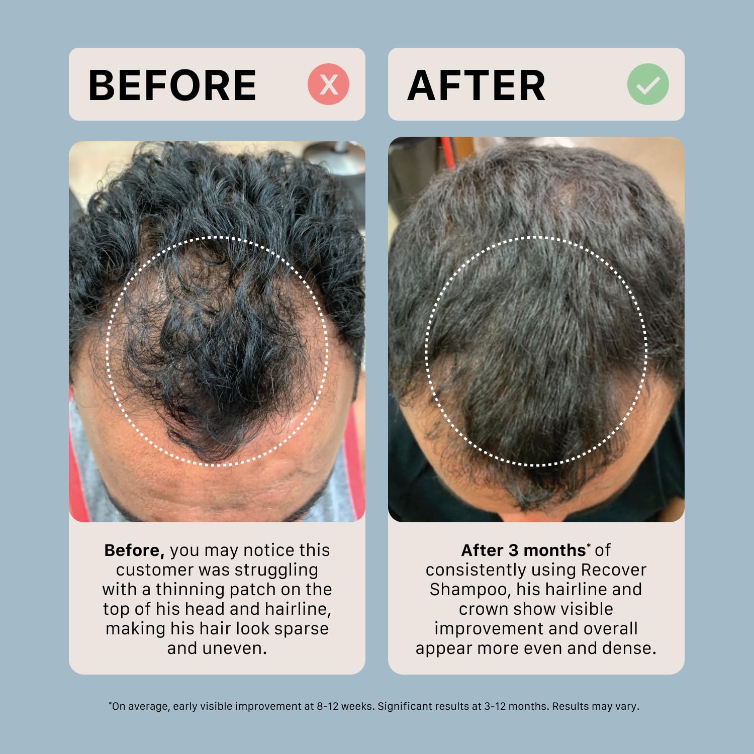 ACTIIV Recover Shampoo on shower ledge illustrating daily routine use