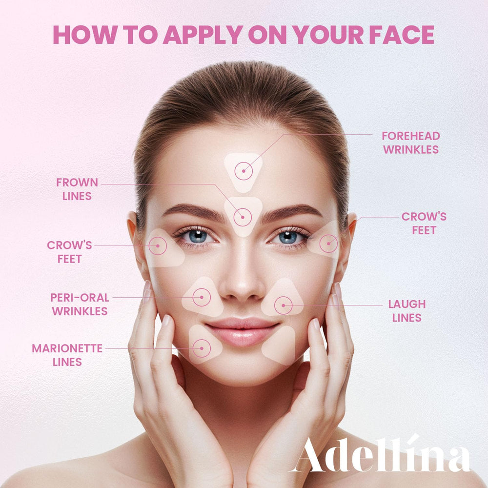 Adellina patches on smile lines reduce visibility overnight