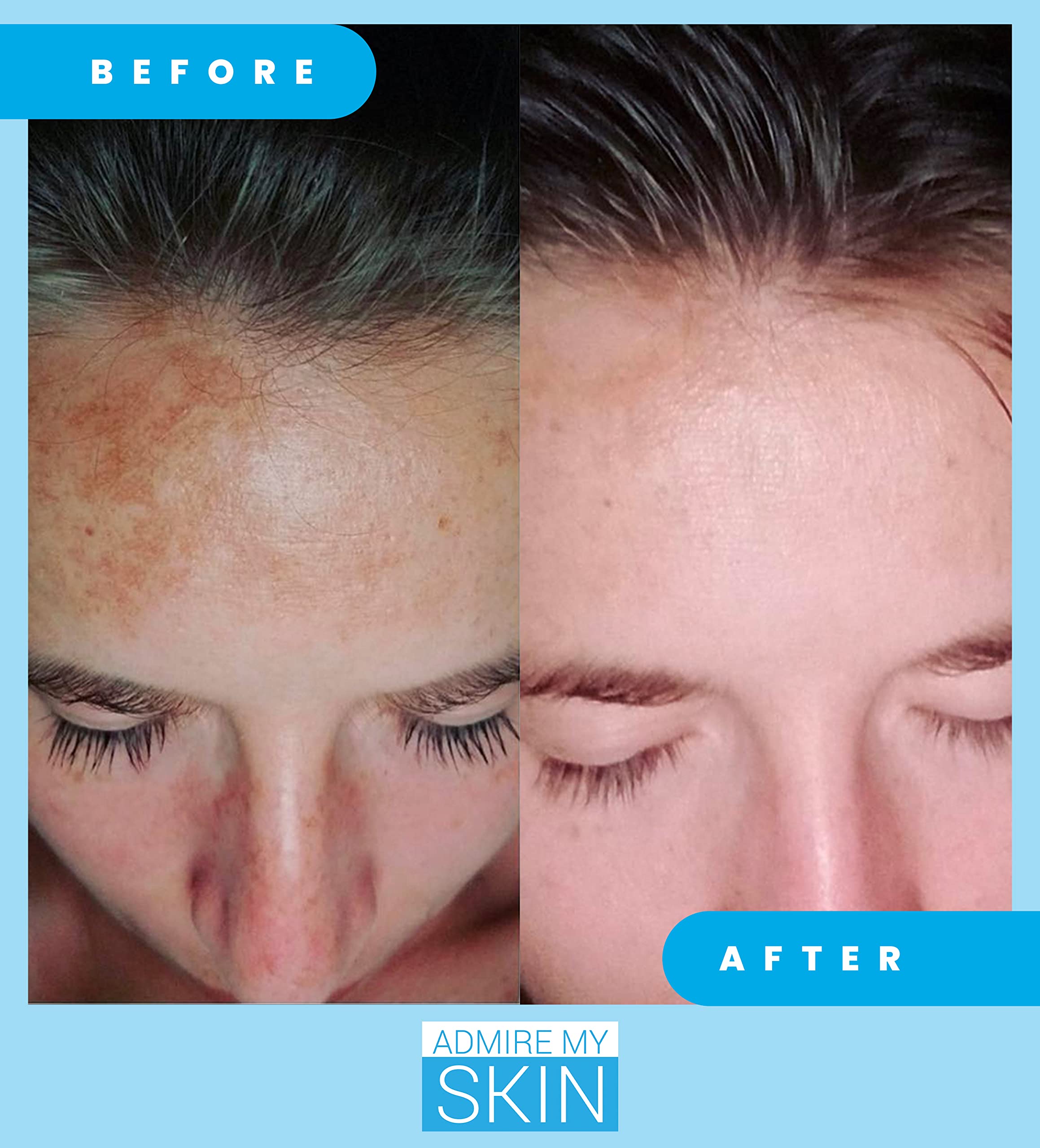 Admire My Skin night routine close-up applying serum to face.