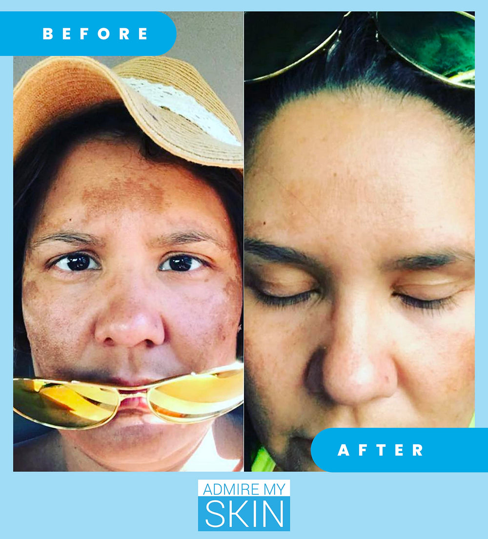 Admire My Skin serum texture close-up highlighting light fast absorbing formula.
