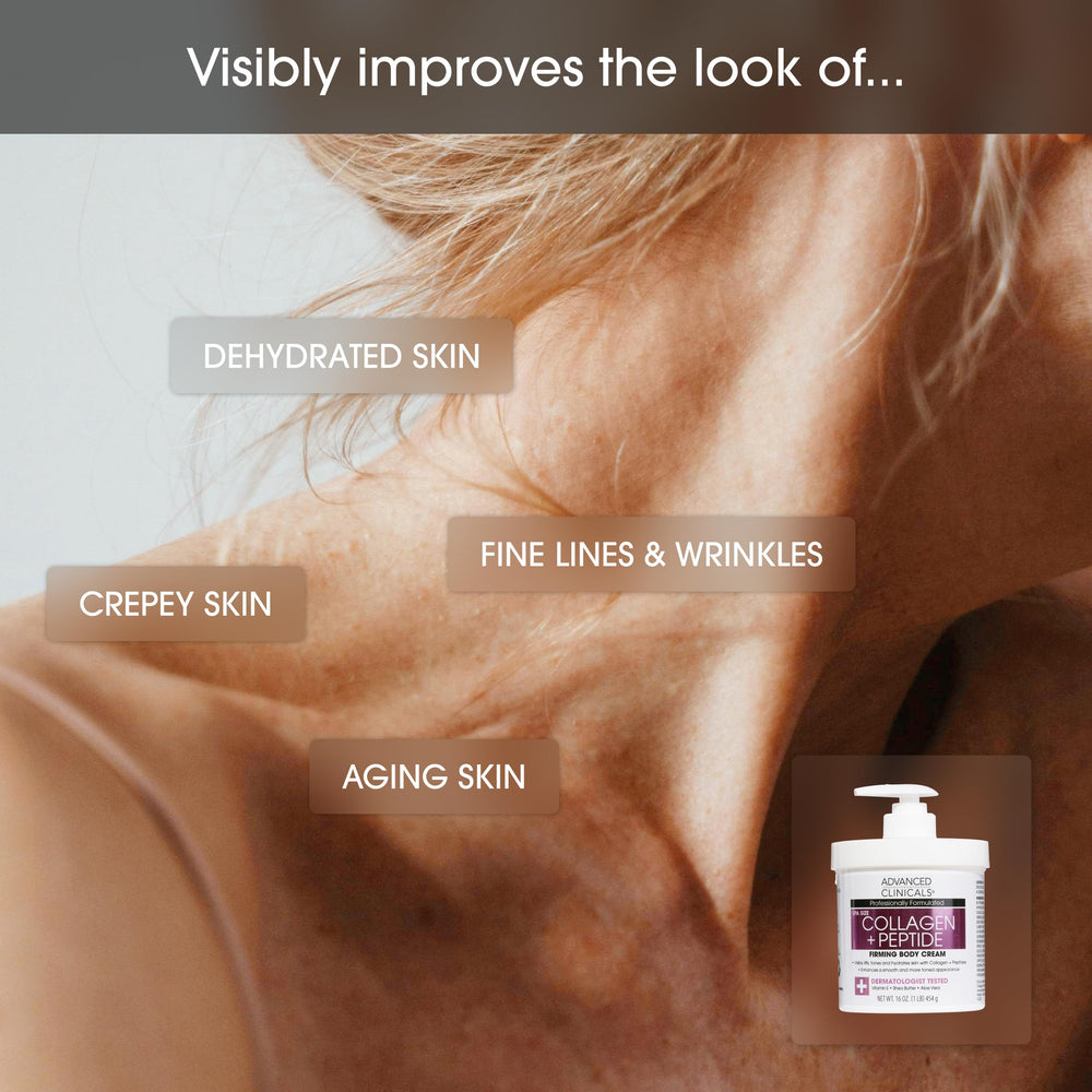 Neck area with Collagen Peptides lotion showing smoothing crepey skin appearance