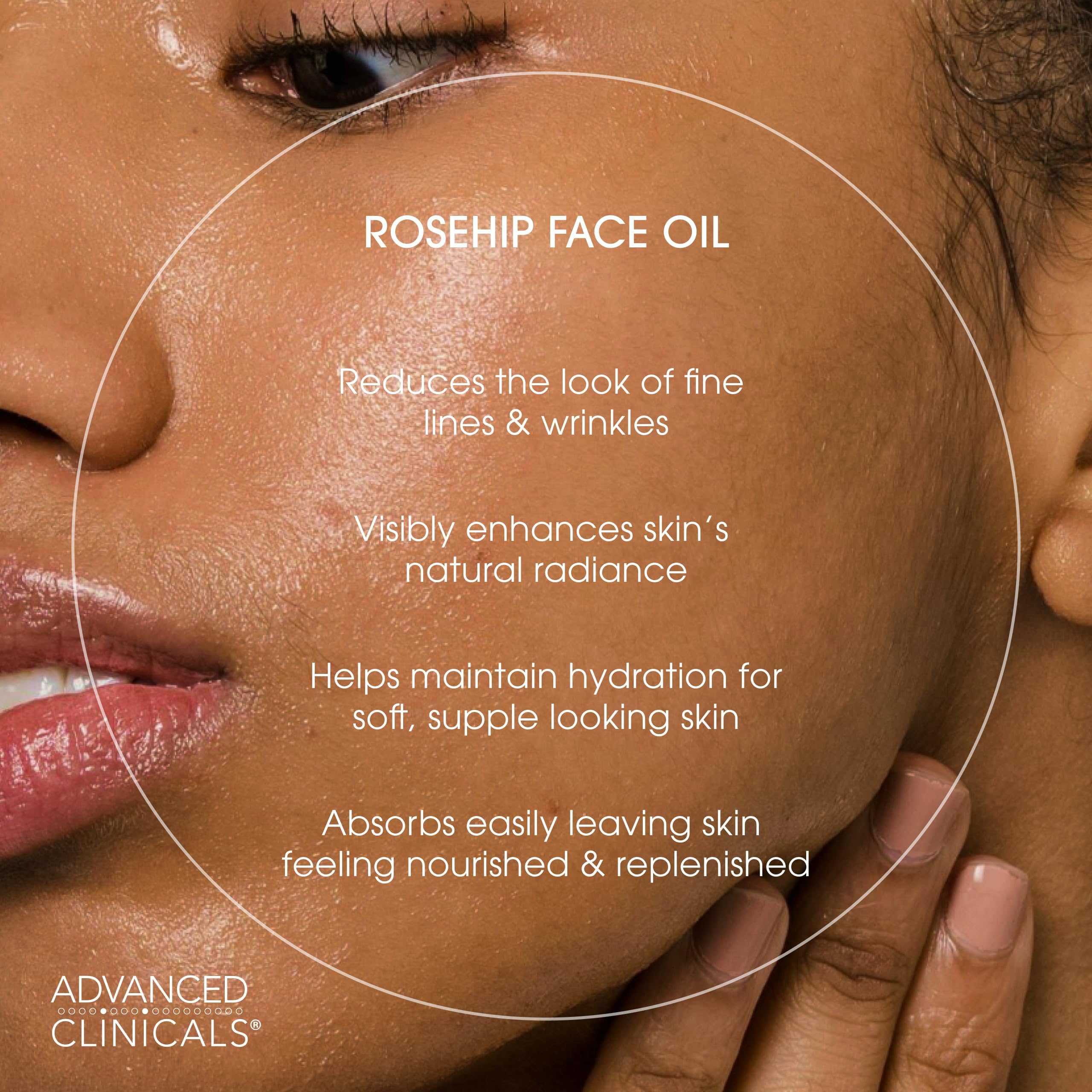 Advanced Clinicals Rosehip Oil supports dry or aging skin, softening fine lines.