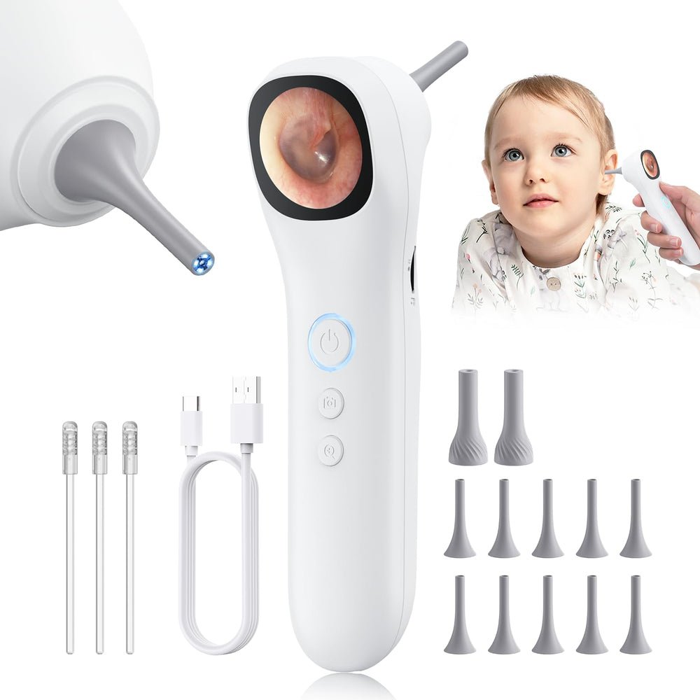 Aertnelz Otoscope camera on 1.21 inch screen shows clear ear visuals for home checks
