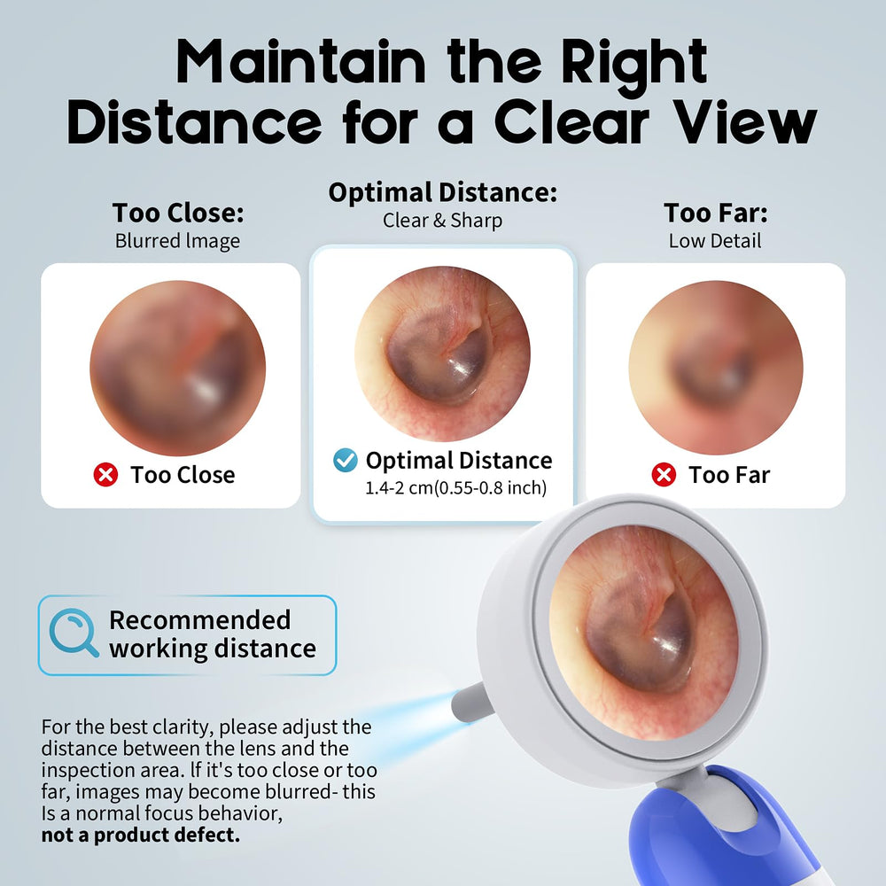 Aertnelz Otoscope family-friendly design for all ages.