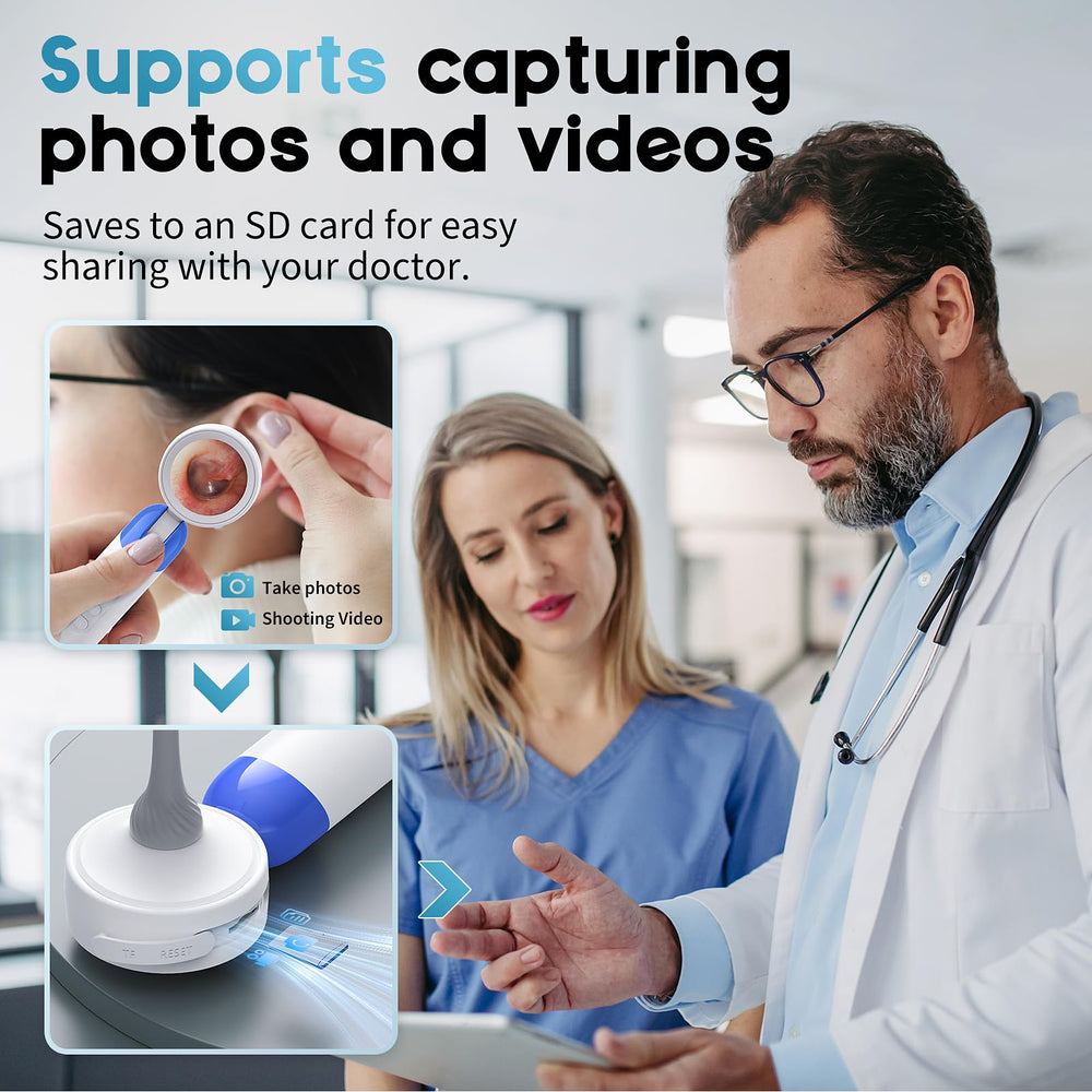 Aertnelz Otoscope USB-C data transfer for PC viewing.