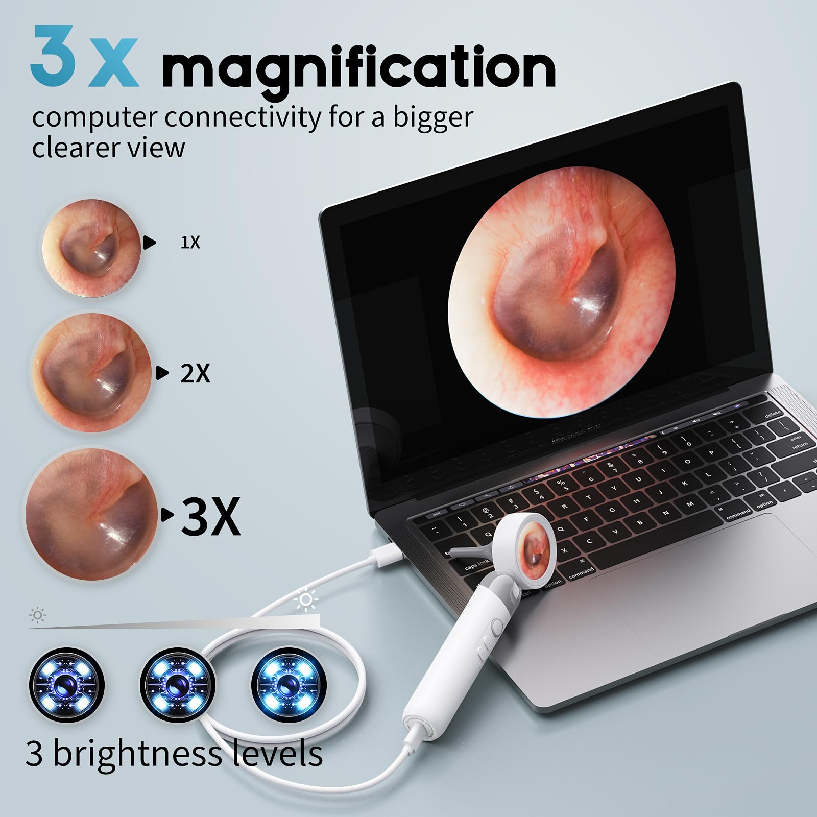 Aertnelz Otoscope shows two replaceable tips for different examination needs.