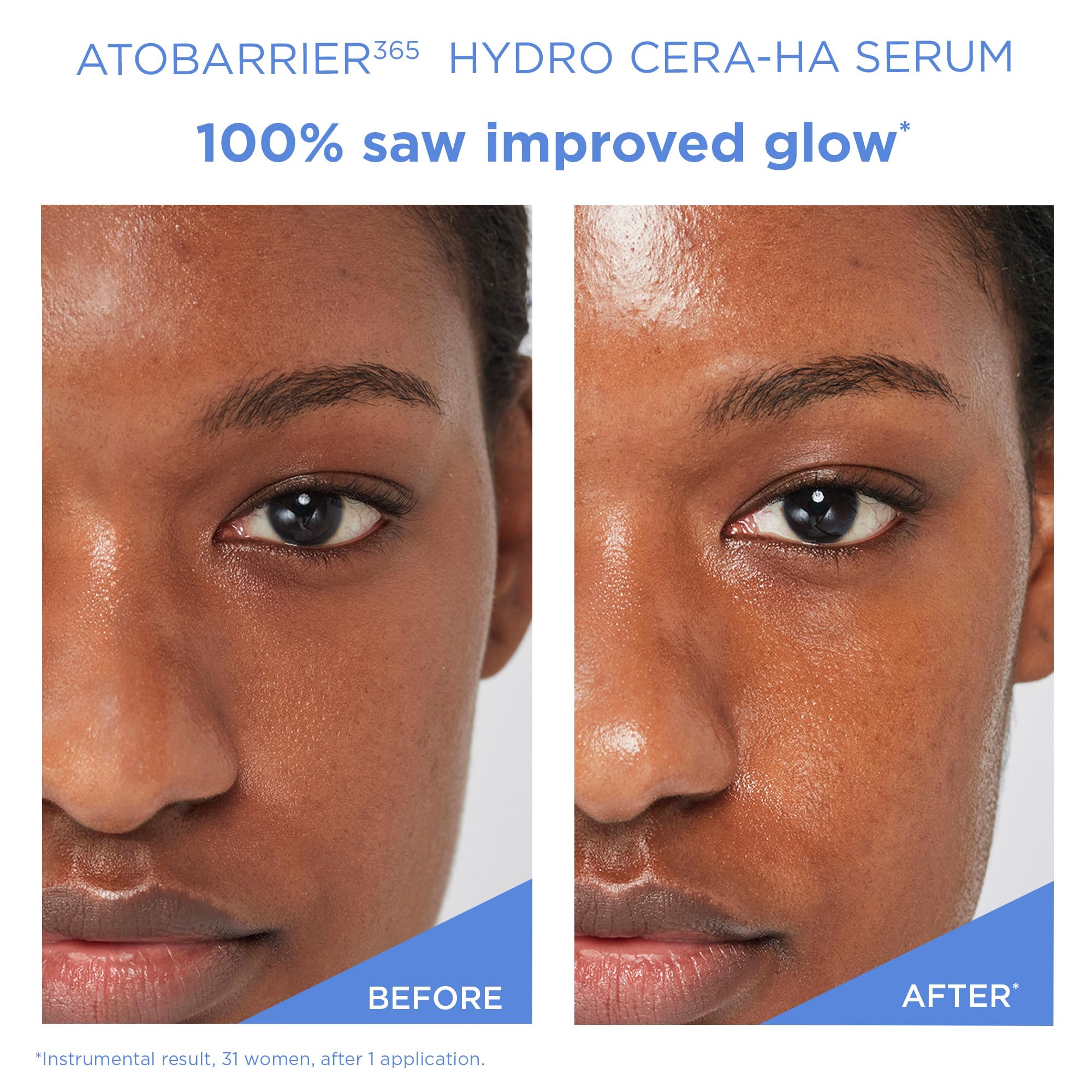AESTURA ATOBARRIER365 allergy-tested, fragrance-free formula for sensitive skin.