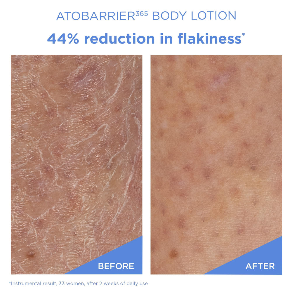 AESTURA ATOBARRIER365 ceramide capsules close-up illustrating advanced barrier support.