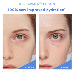 AESTURA ATOBARRIER365 ceramide-ingredients closeup signals high-density barrier restoration.