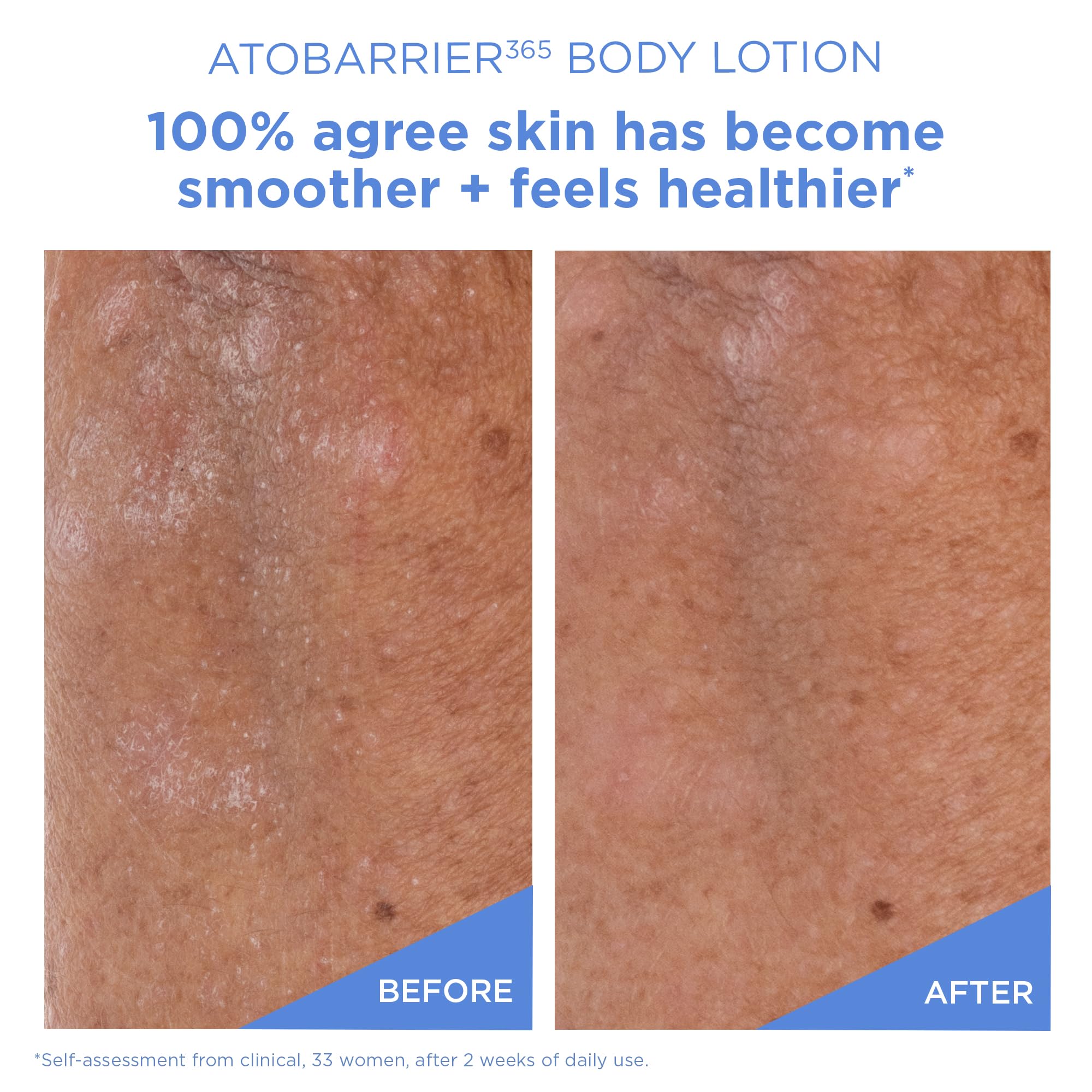 AESTURA ATOBARRIER365 cream texture on skin, silky and fast-absorbing hydration.