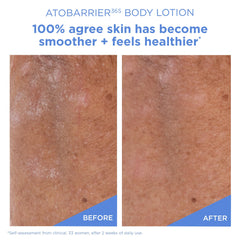 AESTURA ATOBARRIER365 cream texture on skin, silky and fast-absorbing hydration.