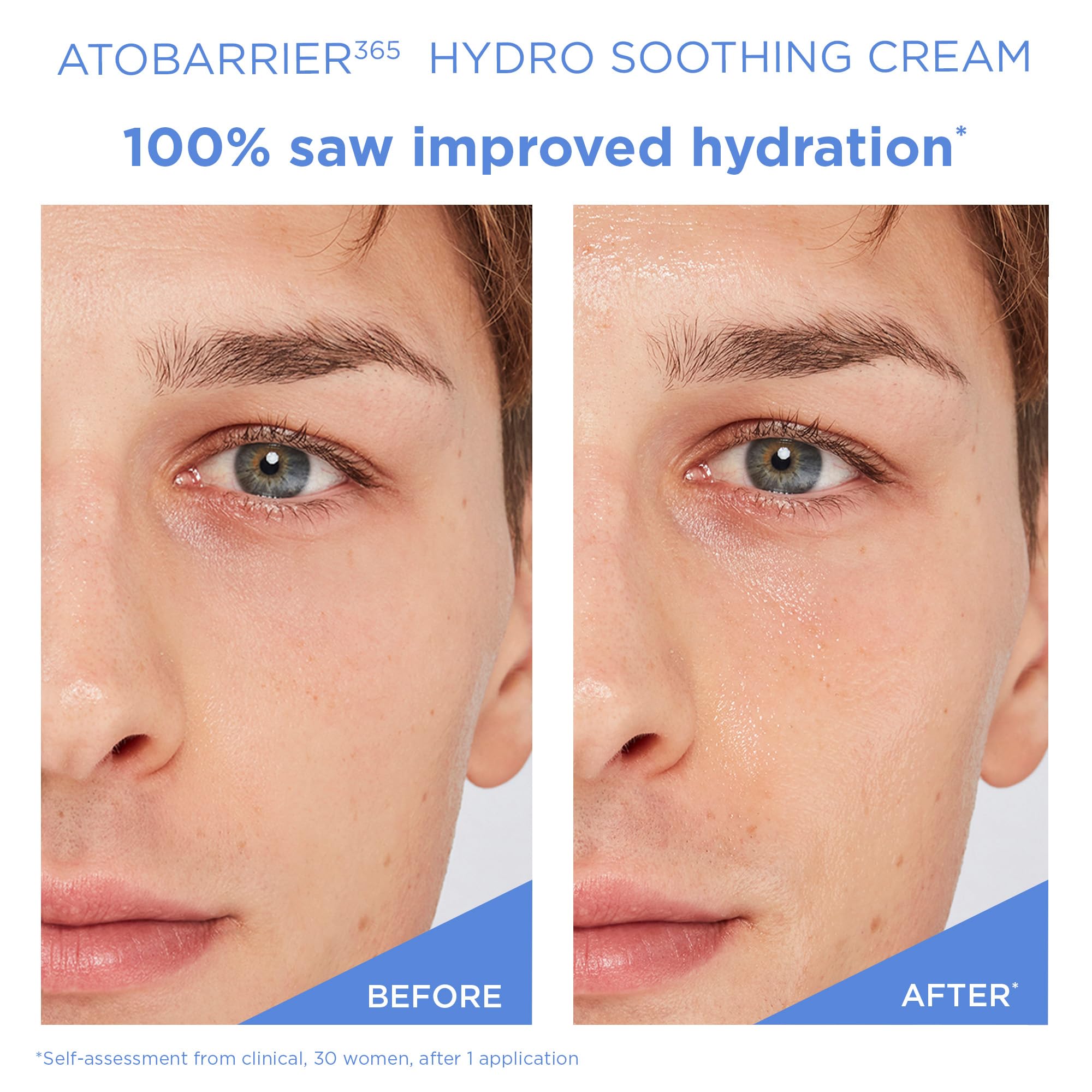 AESTURA ATOBARRIER365 lifestyle shot shows use after mask-wearing for refreshed skin.