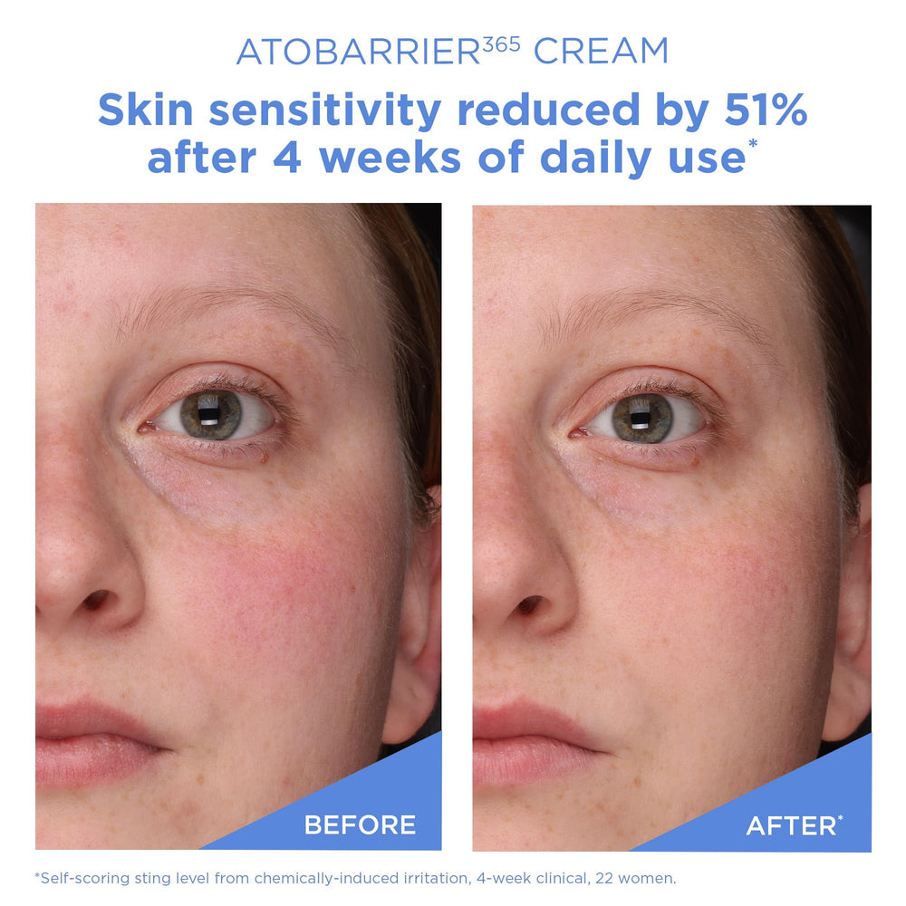 AESTURA ATOBARRIER365 Vitamin E and Squalane ingredients close-up highlighting nourishment.