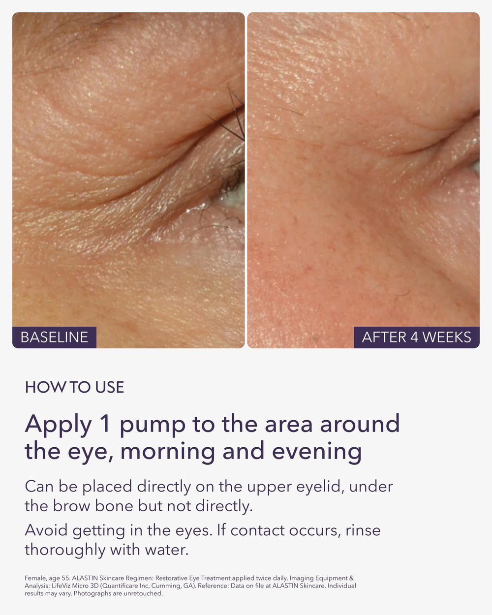 ALASTIN Restorative Eye Treatment texture swirl demonstrates creamy formula for hydration