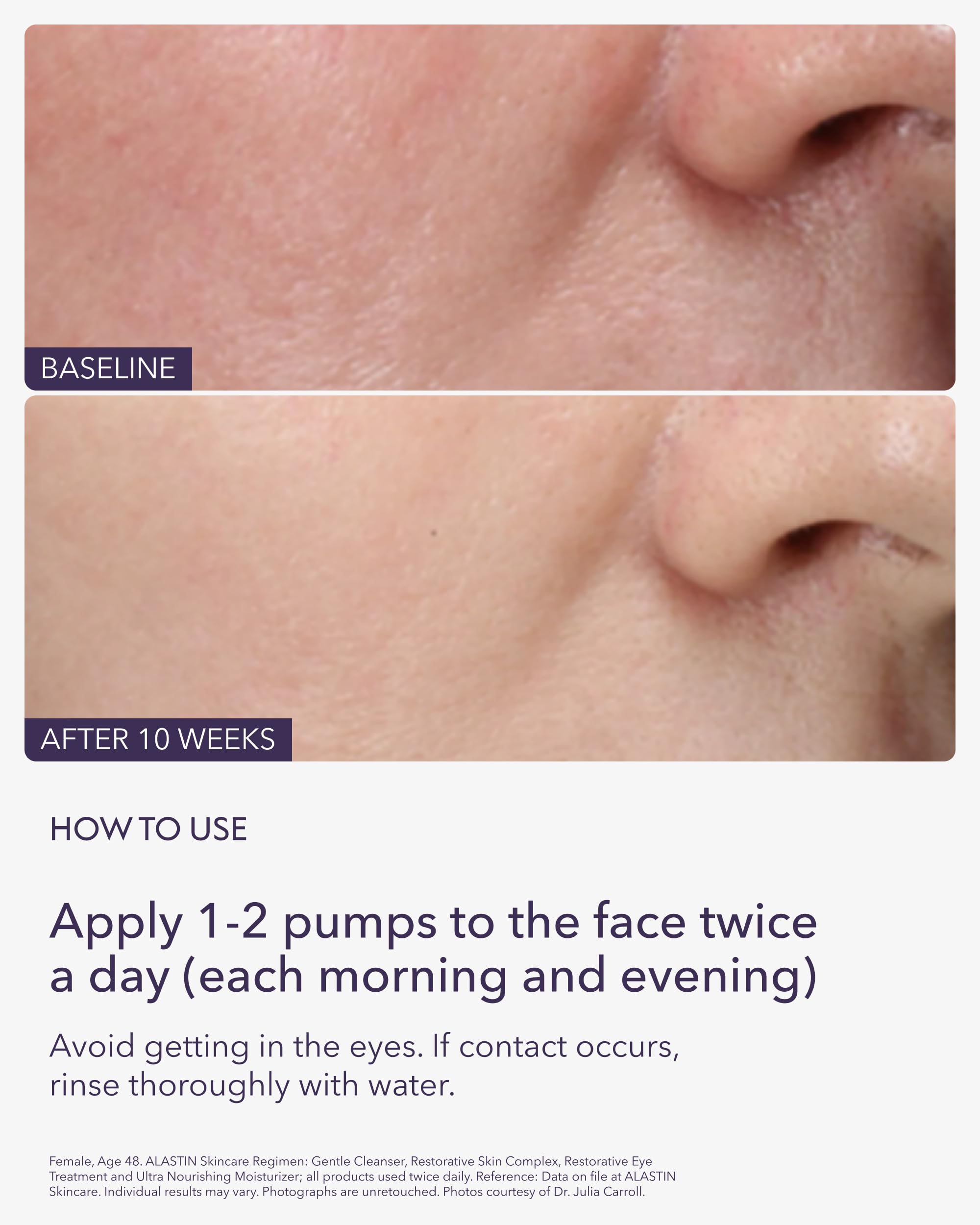 ALASTIN Restorative Skin Complex in routine use, suitable for morning or night hydration.