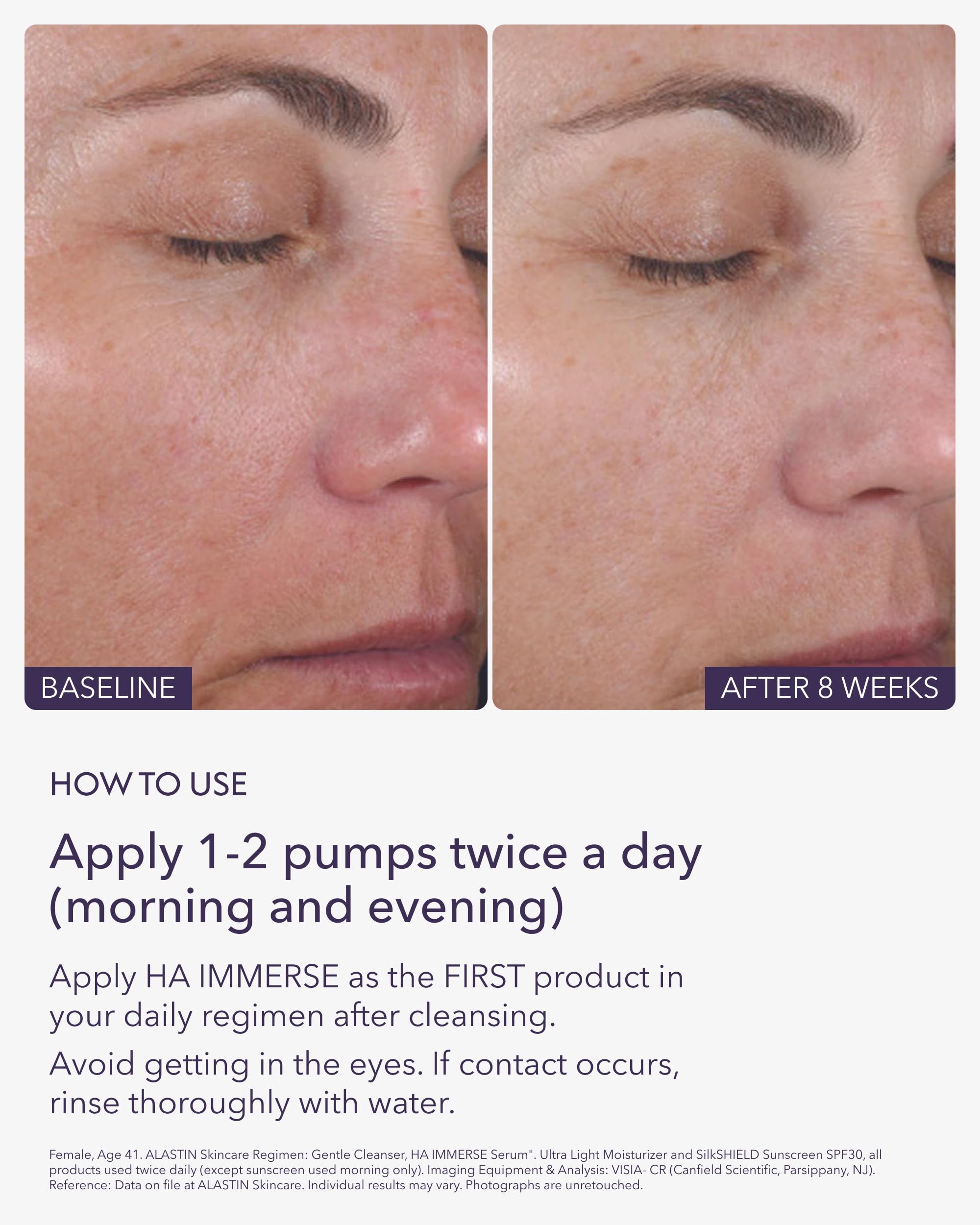 Moisturized skin close-up after applying ALASTIN Skincare HA IMMERSE.