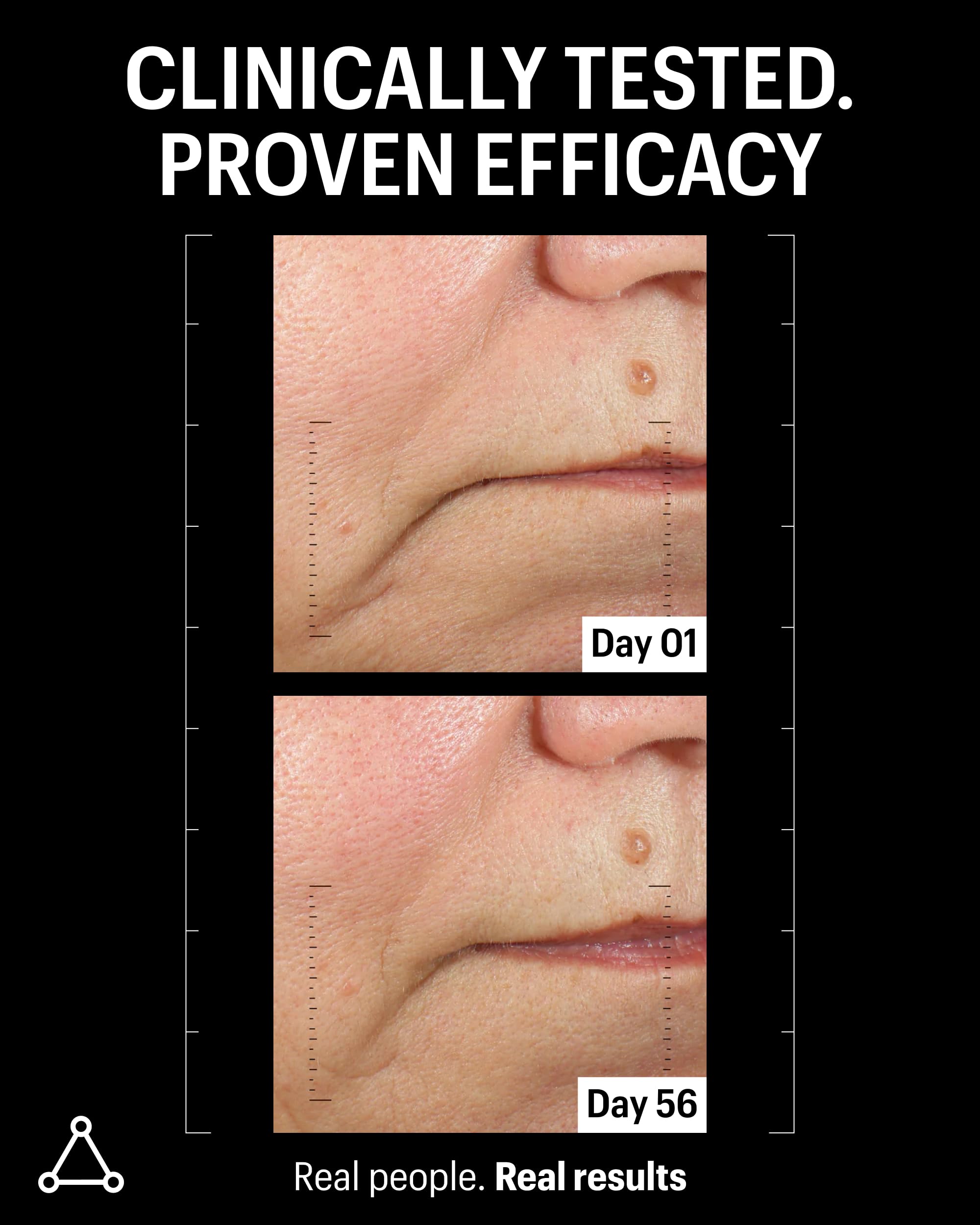 Close-up of Teprenone and Ferulic Complex highlights resilience and antioxidant protection.
