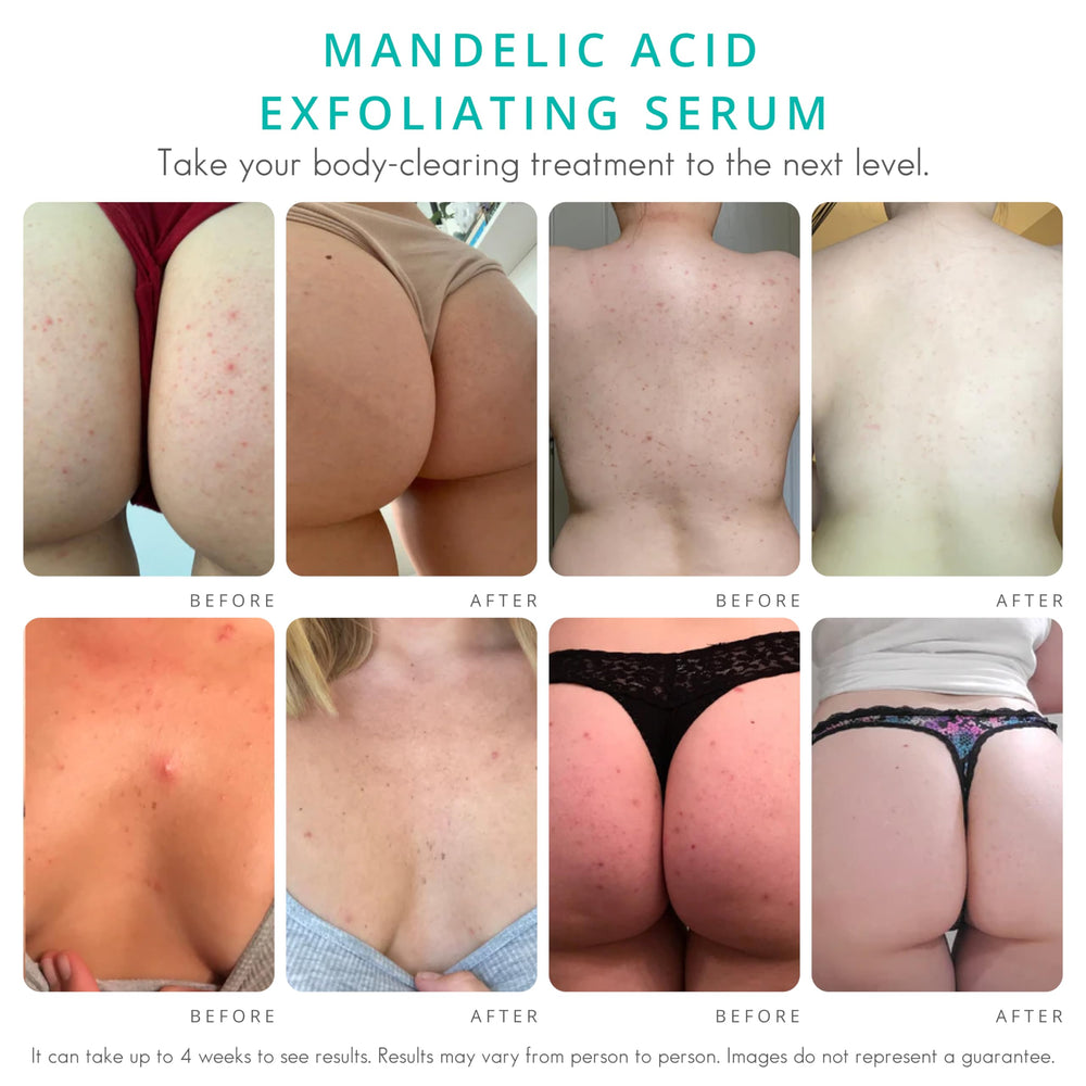 Almond Clear texture closeup demonstrates creamy exfoliating formula for rough skin.