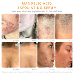 Almond Clear mandelic serum targets dark spots for a more even tone.