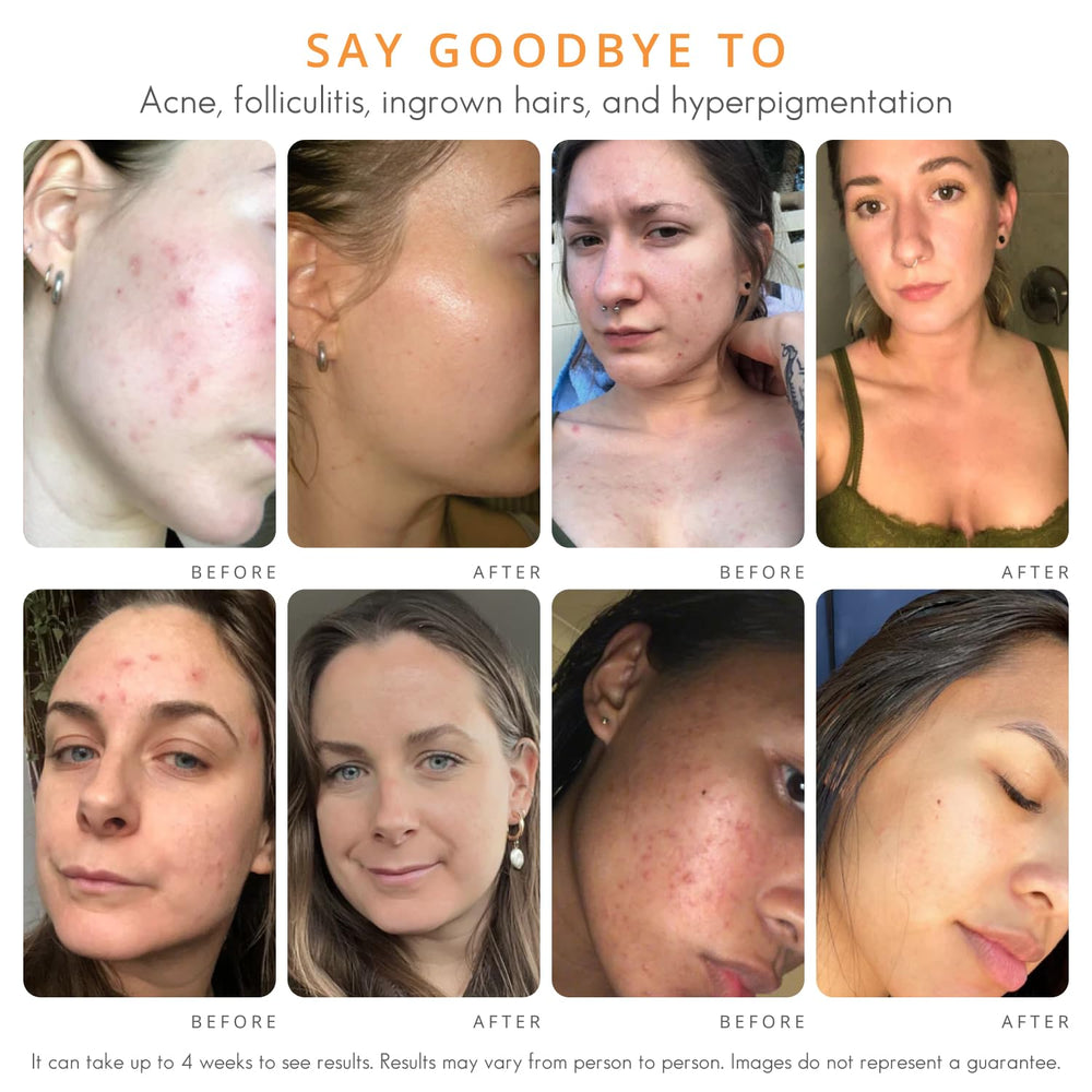 Almond Clear face and body routine shot demonstrates versatile use.