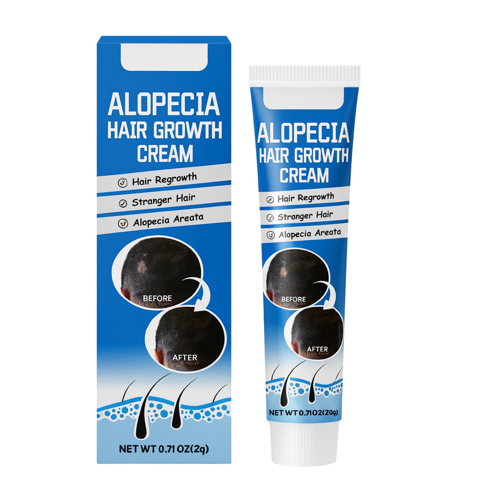 Alopecia Hair Growth Cream bottle for easy daily application supporting scalp care.