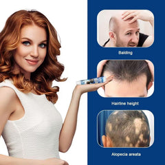 Alopecia Hair Growth Cream herbal ingredients highlight natural care benefits.