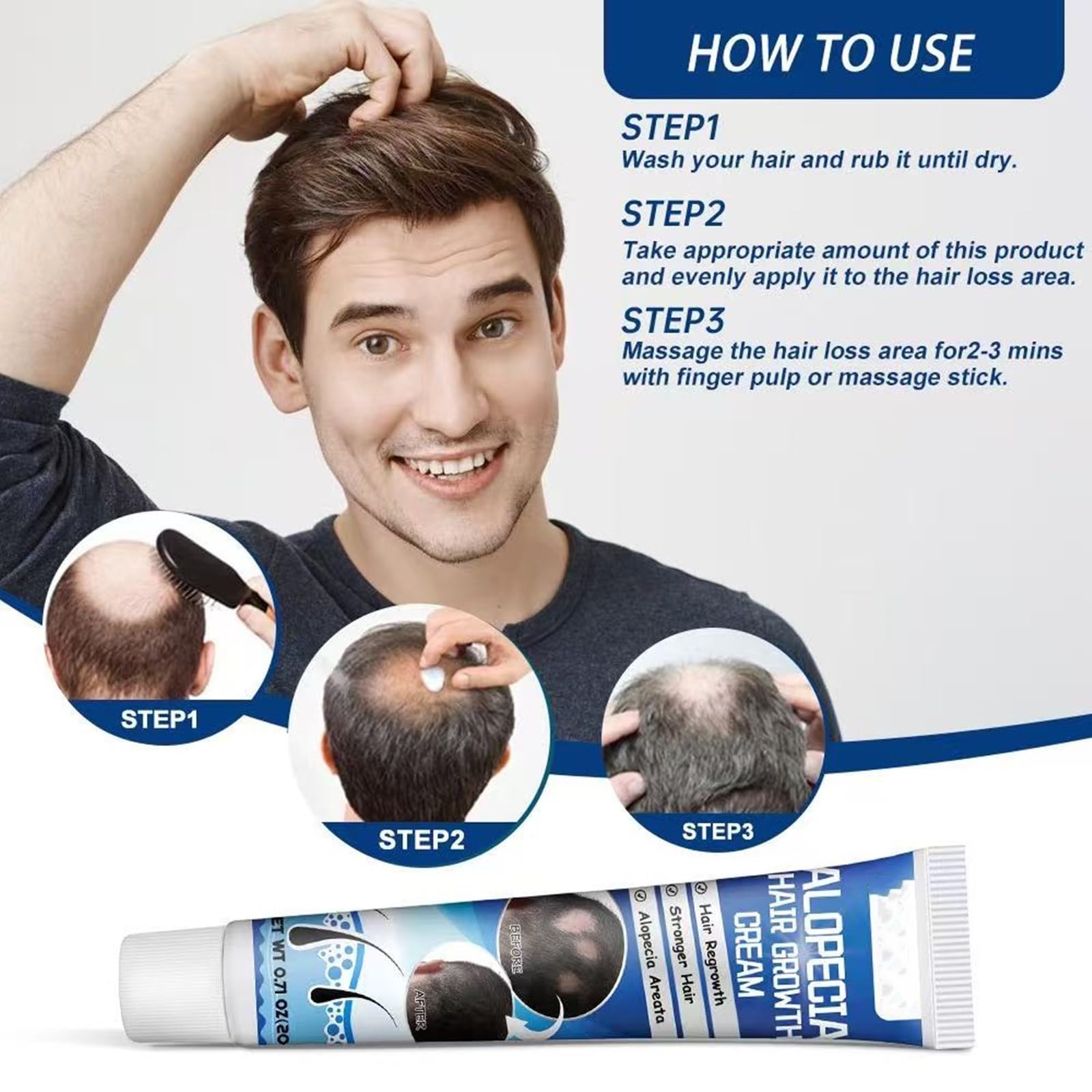 Alopecia Hair Growth Cream on scalp demonstrating potential regrowth support.