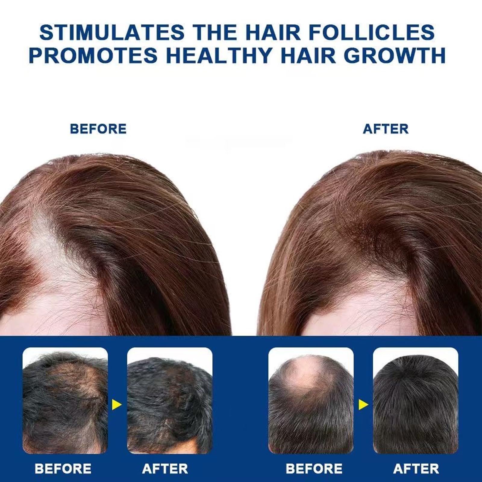 Alopecia Hair Growth Cream packaging emphasizes travel-friendly, lightweight routine.