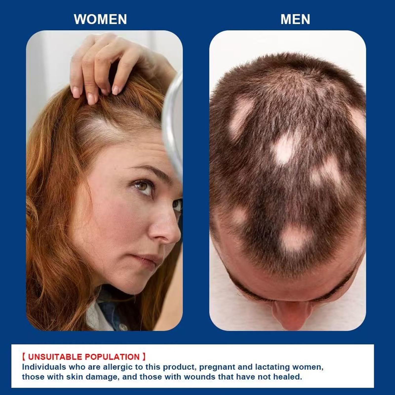 Alopecia Hair Growth Cream texture close-up of smooth, fast-absorbing formula.