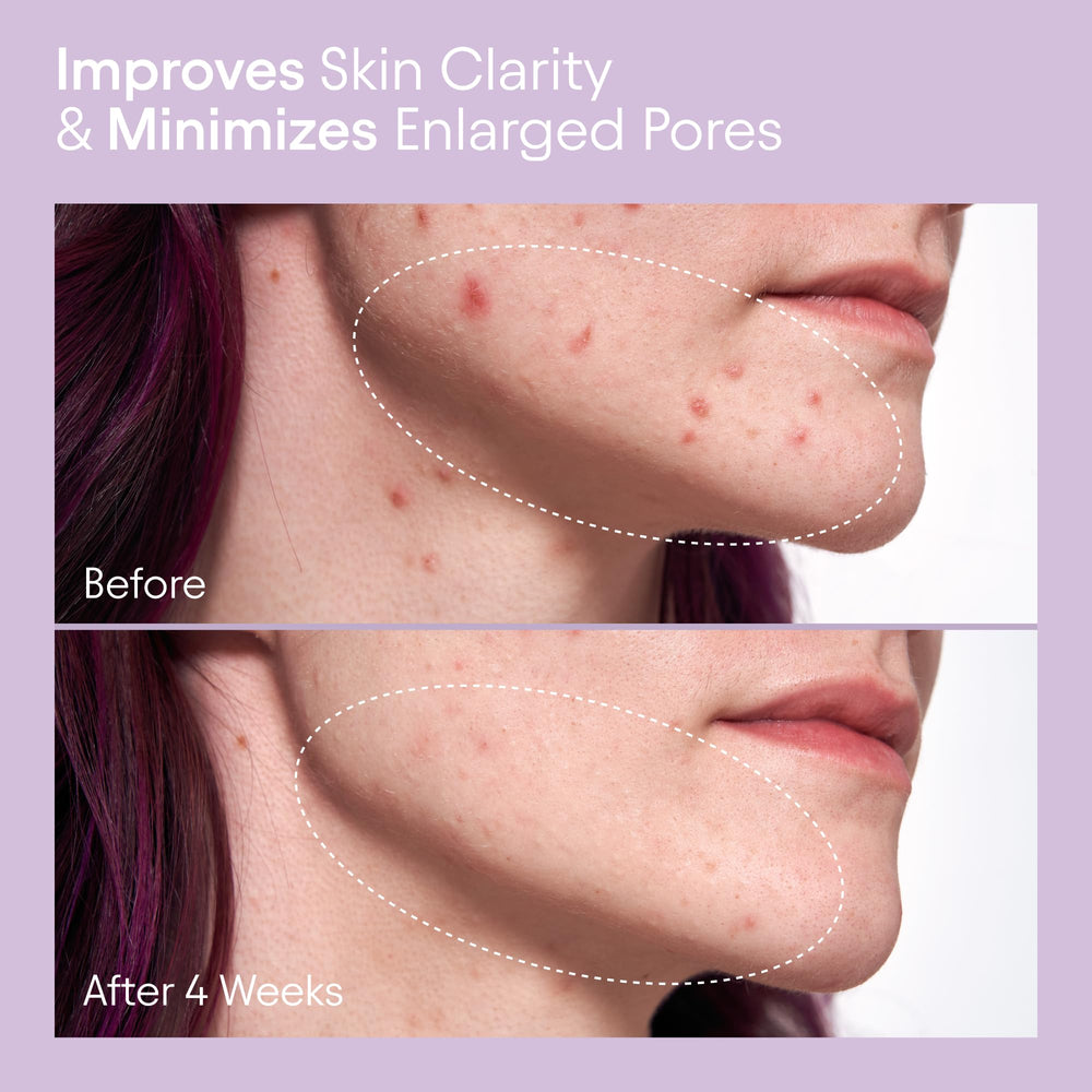 Alpyn Beauty liquid exfoliator highlights 2% BHA for clearer skin.